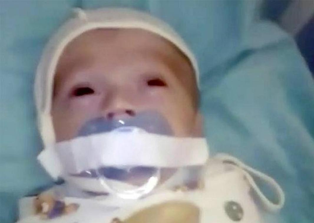 La vidéo d'un bébé hospitalisé avec la tétine scotchée à la bouche
